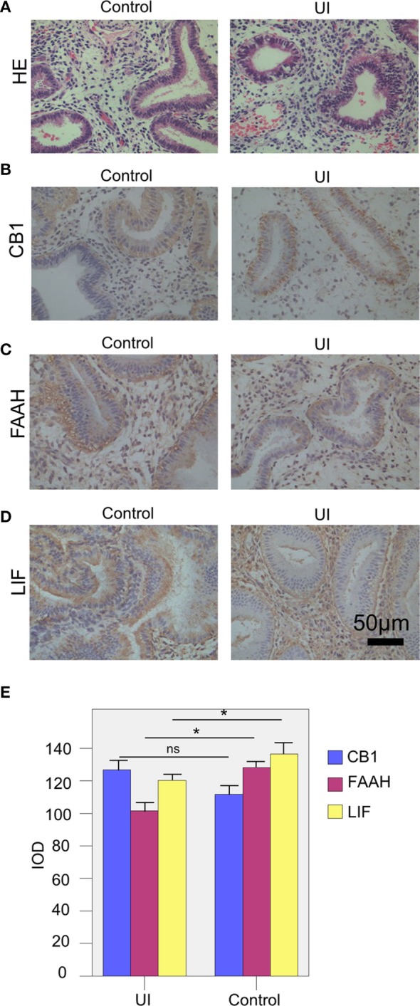 The expressions of the endocannabinoid system and leukemia inhibitory factor (LIF) of the two groups. (A) The HE staining of the endometrium tissue of the patients in the two groups. (B,C) The levels of CB1 (B), fatty acid amide hydrolase (FAAH) (C), and LIF (D) of the patients in the unexplained infertility (UI) and control groups were measured by immunohistochemical staining. (E) The integral optical density (IOD) values of CB1, FAAH, and LIF of UI group (n = 28) and control group (n = 32). The expressions of FAAH and LIF of UI group were significantly lower than the control group. The experiments were repeated three times. The results were presented as mean. The significance of the variation was summarized in Table 5. *P < 0.05.