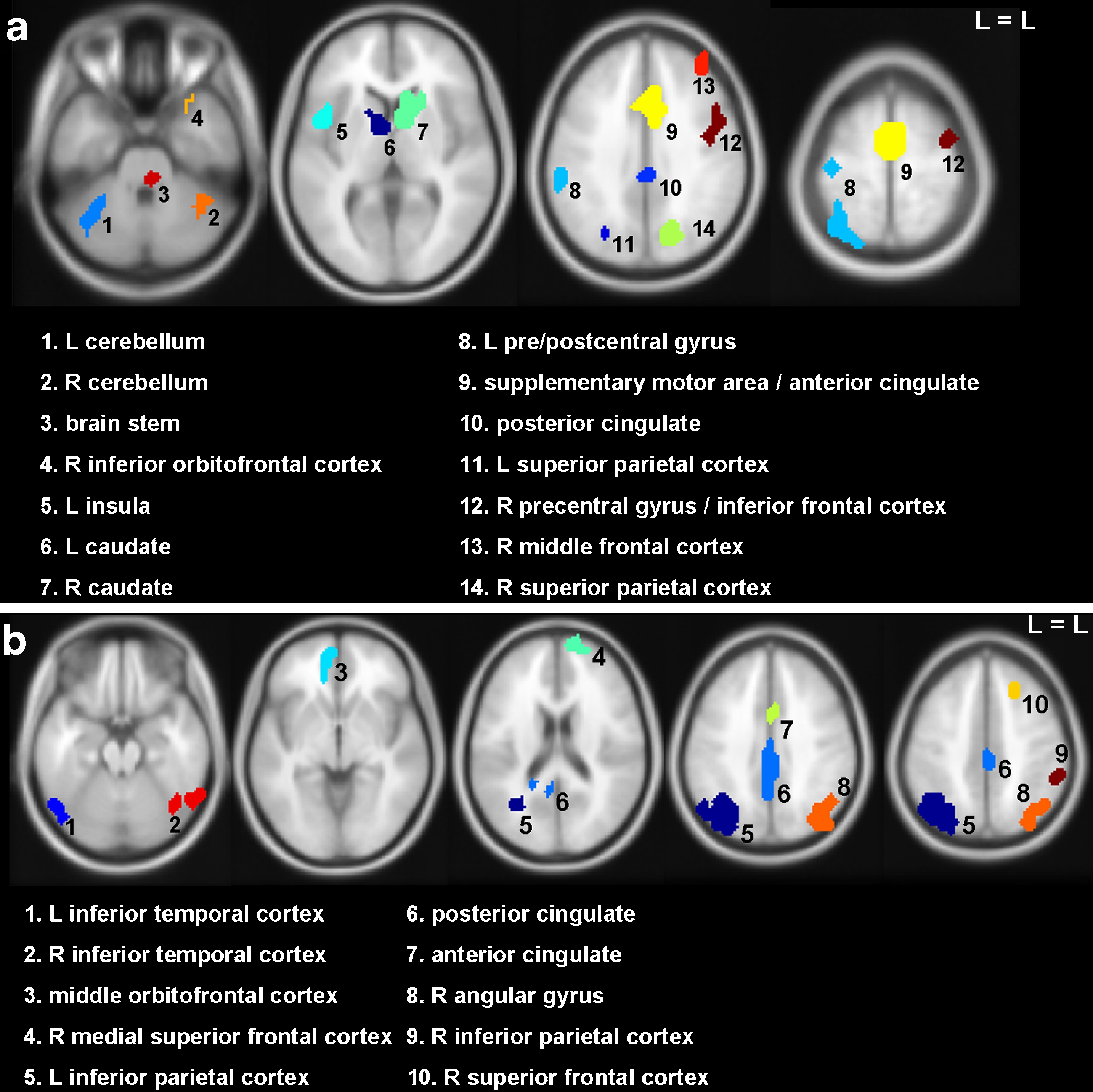 Regions of interest; based on pooled group activation maps of THC and placebo; a reward anticipation; b reward feedback. L = left, R = right