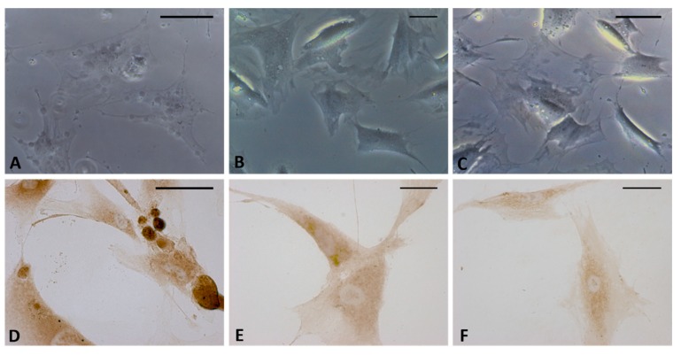 Bright field images (A–C) and immunostaining with HABP (D–F) of fascial cells treated for 4 h with HU-308 2.5 µM (A,D), AM630 2.5 µM (B,E), and HU-308 and AM630 2.5 µM (C,F). HA-rich vesicles are evident only in cells treated with agonist HU-308. Scale bars: 25 µm.