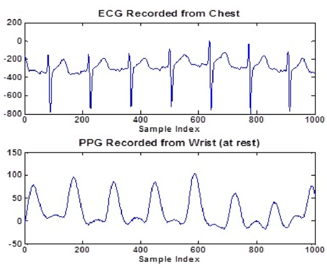 Sample ECG and PPG signal illustrating chest and wrist band calculations at rest and during physical activity