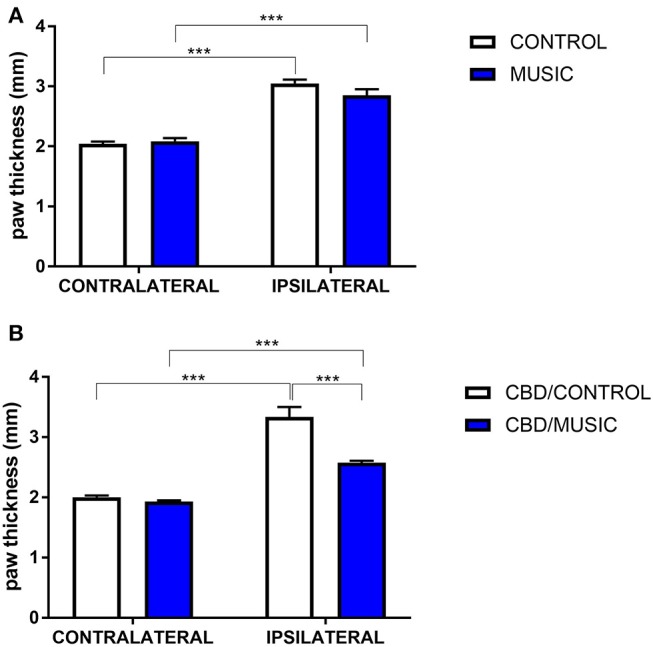 Effects of music-based intervention on paw thickness (edema) following carrageenan administration in CD-1 mice. (A)—Carrageenan-injected (ipsilateral paws) show increased thickness (caliper measurement across the dorso-ventral aspect of the paw) compared to non-injected (contralateral) paws (MUSIC–blue; CONTROL–white). (B)—effects of music (MUSIC–blue; CONTROL–white) on activity of Cannabidiol (CBD, 100 mg/kg) following i.p. administration. CBD was administered 120 min prior to testing. Edema was observed following carrageenan in animals exposed to control conditions whereas music-exposed and CBD-treated animals show a diminished edema. N = 6–8 per group. ***P < 0.001. Data were analyzed using a two-way ANOVA followed by a Bonferroni post-hoc test.