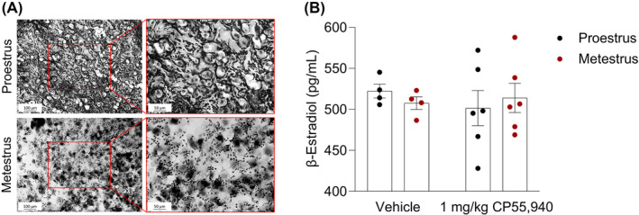 Estrus cycle phase determination. (A) Representative light microscopy images of vaginal samples from vehicle‐treated female mice in either proestrus or metestrus. A lavage of ddH2O collected loose epithelial and blood cells within the vaginal canal the female mice. The majority of cells (>80%) in the proestrus sample are nucleated epithelial cells that are round in shape and contain a pigmented nucleus at the center. The metestrus sample contains a combination of un‐nucleated cornified squamous epithelial cells (~40%) and much smaller, darkly stained leukocytes (~60%). These different cell types and morphologies indicate estrus cycle‐driven sex hormone fluctuations, especially that of β‐estradiol. (B) β‐estradiol ELISA results validating phase determination of vehicle‐ and CP55,940‐treated groups. Immediately following the tetrad battery of behavioral assays, blood was collected from all mice. Plasma was measured for circulating β‐estradiol content. Each point on the graph constitutes individual mice or n. Bars on the graph illustrate means ± SEM, where n = 4–6 mice/group. A paired t‐test determined no significant difference between the groups