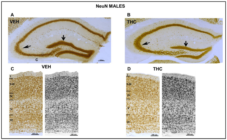 Low microscope magnification photomicrographs of NeuN-immunostained coronal sections of the HIPP and somatosensorial cortex in male mice. Image of NeuN-ir neurons in the VEH and the THC of male pups (A,B) at PND 60. A decrease in CA3 and DG (arrows) layers was observed in THC male (B) mice. Laminar organization of the somatosensory cortex of the VEH (C) and THC (D) offspring showed aberrant laminar organization of the cortex of THC pups compared to that of VEH mice. Note the increase in density in layer VI and the lower density in layers II–III in THC pups according to the migration pattern of the neocortex compared with that of the VEH mice—same scale for (A,B) and (C,D).