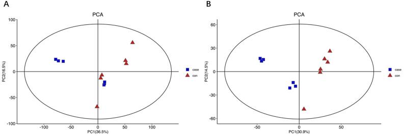 Score plot of principal component analysis (PCA). Closed triangle, control (six samples); closed square, pulpitis group (six samples) (A) Score plot of the PCA model in the positive mode; (B) Score plot of the PCA model in the negative mode.