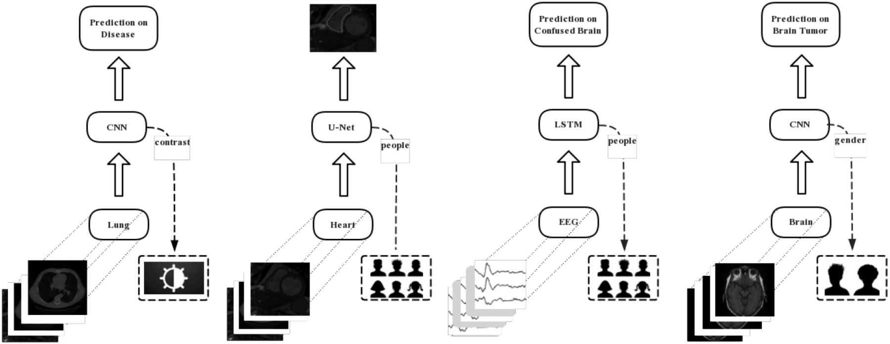 An illustration of the empirical contribution of this paper. From left to right, 1) lung adenocarcinoma prediction from CT-scan with CNN, where contrast material is the confounding factor, 2) heart right ventricle segmentation from CT-scan with U-net, where subject identification is the confounding factor, 3) students’ confusion status prediction from EEG signals with Bidirectional LSTM, where the students’ demographic information is the confounding factor, 4) brain tumor prediction from CT-scan/MRA with CNN, where gender associated information is the confounding factor.
