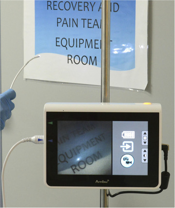 A view monitor to be used with the aScope