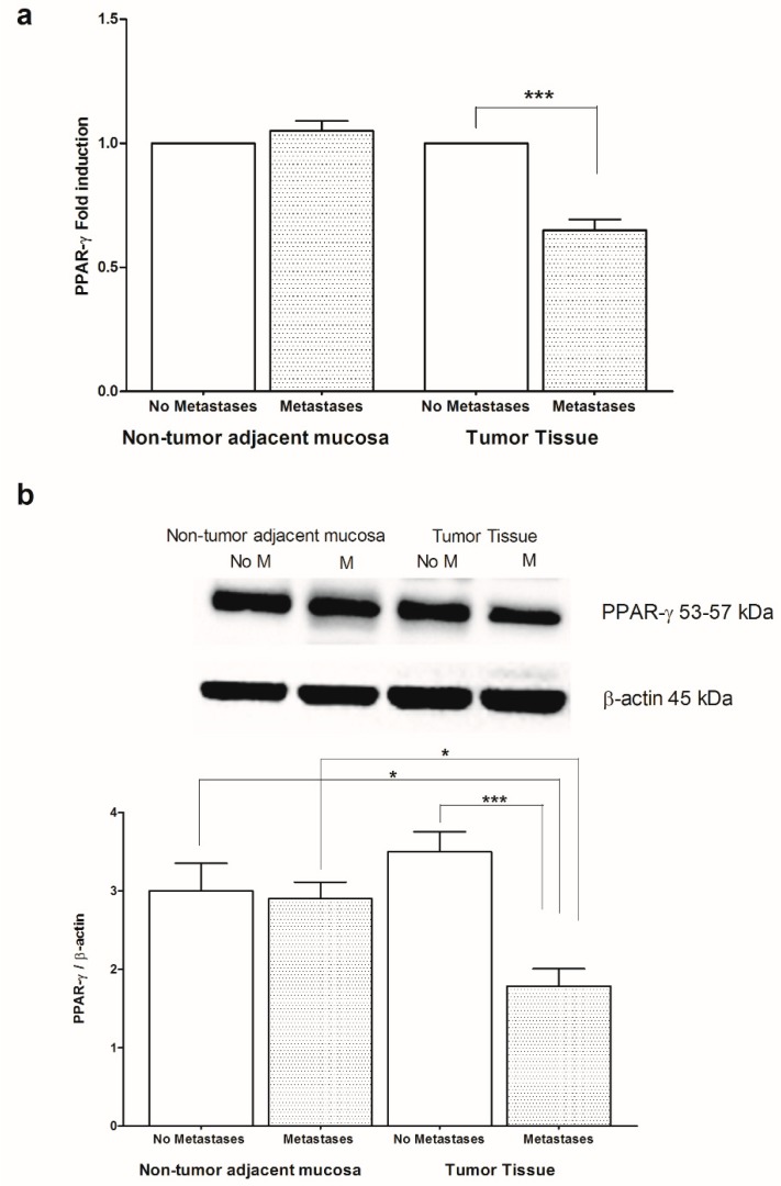(a) Peroxisome proliferator-activated receptor gamma (PPAR-γ) mRNA levels in non-tumor adjacent mucosa and tumor tissue from colorectal cancer patients with and without metastases. Data are expressed as Fold induction. *** p < 0.005 (Student’s t-test). (b) Western blotting analysis of PPAR-γ protein in the same patients. Representative blots are also shown (No M = No Metastases; M = Metastases). * p < 0.05, *** p < 0.005 (ANOVA and Tukey’s multiple comparison test).