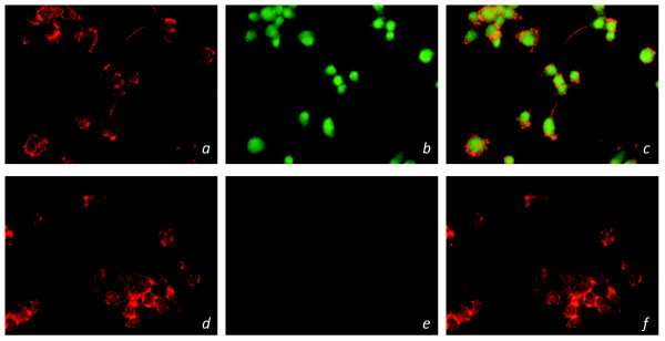 Immunocytochemical staining of GPR18 receptors in siRNA transfected BV-2 microglia. Immunofluorescent confocal microscopy was conducted using an antibody against the GPR18 C-terminus (1:150; green), phalloidin to label actin (1:40; red). Normal BV-2 microglia with: a) phalloidin b) GPR18 antibody c) phalloidin and GPR18 antibody. GFP+ GPR18 siRNA transfected BV-2 microglia with: d) phalloidin e) GPR18 antibody f) phalloidin and GPR18 antibody.