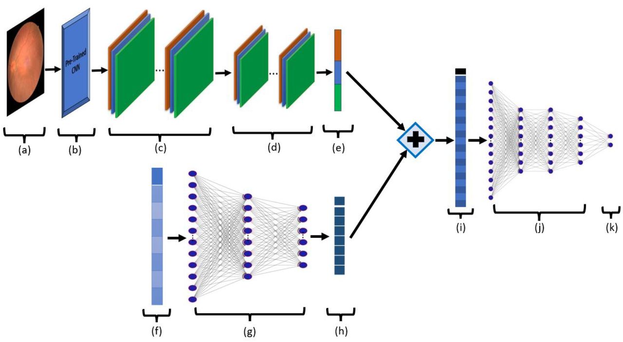 Architechture of Topo-Net modelOur model takes two inputs (a) fundus image and (f) topological feature vector of the fundus image. In the top row, we run our CNN layers: (b) Pre-trained model weights (c) convolution layer (d) Max pooling layer, and (e) Flatten. In the bottom row, we run (g) feed-forward network on topological features to effectively adapt them into our model. We then concatenate (+) the produced vectors (e) and (h) and obtain (i). We run another feed-forward network to get our predictions.