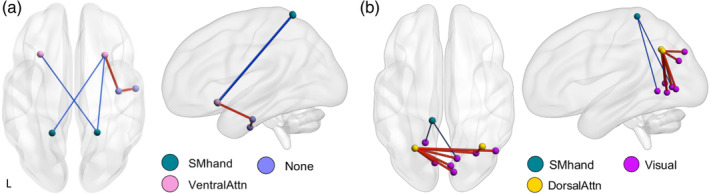 Affected network in CUD at F ≥ 15, based on intensity (a) and extent (b). Red/thick edge, stronger functional connectivity in CUD; Blue/thin edge, weaker functional connectivity in CUD. SM, somatomotor cortex; Attn, attention