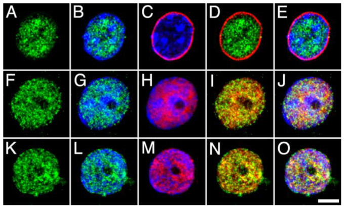 High-power micrographs of intact nuclei isolated from the adult rat brain cortex double stained with anti-ABHD12 (green) combined with Hoechst staining (blue) and NPCx ((A–E); red), NeuN/Fox-3 ((F–J); red) and DGLα ((K–O); red) immunostaining. All micrographs are maximum intensity projections of three consecutive 0.24 µm-thick optical sections acquired in grayscale and pseudo colored. Scale bar = 5 µm in O (applies to (A–O)).