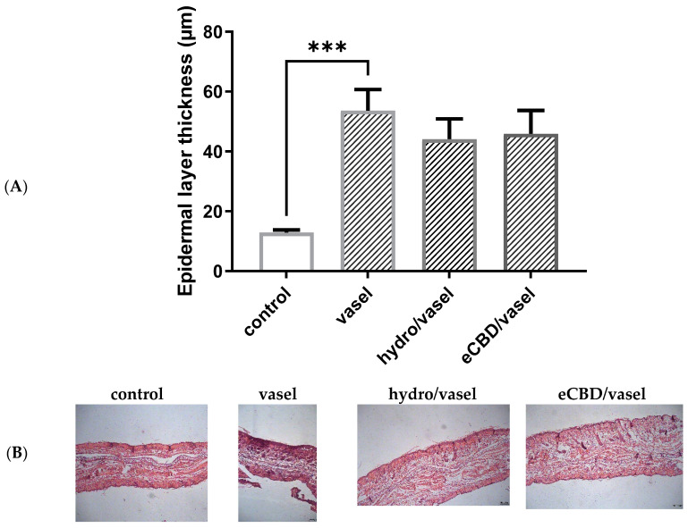 The effect of high-cannabidiol Cannabis sativa extract (eCBD) ointment on mean epidermal-layer thickness (A), and hematoxylin-eosin (H&E) staining of 5 μm paraffin-embedded sections from the skin of the rat’s ear (B) on DNCB-induced dermatitis. The 2,4-dinitrochlorobenzene (DNCB) solution was administered 9 times over a period of 3 weeks, and the tested ointments, which contained 2% cannabidiol (eCBD/vasel), hydrocortisone 1% (hydro/vasel), or vehicle–Vaseline (vasel), respectively, were applied from day 11. The repeated application of DNCB resulted in a significant increase in epidermal-layer thickness in inflamed skin treated with Vaseline. Treatment with either the ointment containing eCBD or the ointment containing hydrocortisone did not change epidermal-layer thickness in those groups compared to the Vaseline group. The control group consisted of animals without inflammation. In the graphs, the bars filled in with gray correspond to groups sensitized with DNCB. The results are presented as mean ± SEM, n = 6–8, *** p < 0.001 (A). Representative images were photographed under final magnification of 40× (B).