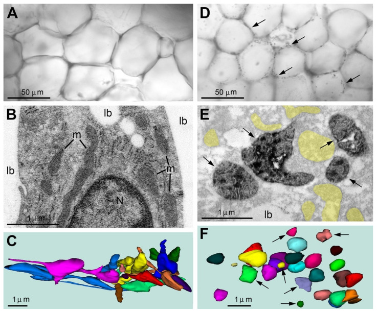Type 2 SLP2-like immunopositive mitochondria indicate necrosis-like ultrastructural pathology in a fraction of white adipocytes from young adult mouse abdomen. Immunolabeling using CB1R-L31 serum showed a negative reaction in a majority of adipocytes (A–C), whereas immunopositive mitochondria were detected in certain tissue segments (D–F). (A) Representative light micrograph of typical immunonegative adipocytes. (B) Electron micrograph of a segment of white adipocyte with the nucleus (N) and cytoplasm sandwiched between two big lipid bodies (lb). Notice the immunonegative mitochondria (m) with dense matrix. (C) 3D reconstruction of mitochondria (shown in distinct colors) from serial sections of an immunonegative adipocyte. Most mitochondria show elongated and branching shapes. Evidence of swelling of the matrix was not encountered, while enlarged segments of the mitochondria in (C) contain electron-dense matrix characteristic of functional mitochondria. (D–F) An arbitrarily chosen fragment of white adipose tissue contains numerous type 2 immunopositive mitochondria (arrows) as visible under light (D) and electron microscope (E). Immunonegative remnants of mitochondria are highlighted yellow. The immunoperoxidase reaction DAB-Ni end product is located in the matrix of the mitochondria while cristae are immunonegative. 3D reconstruction of mitochondria (shown in distinct colors) from serial sections of an adipocyte identifies that the type 2 mitochondria (arrows) as well as immunonegative ones (not pointed) are swollen and spherical-shaped.