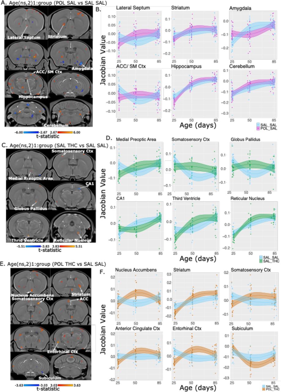 Neuroanatomical alterations due to pre- and/or postnatal risk factor exposure from preadolescence to adulthood. A. Exploration of neuroanatomical alteration due to prenatal MIA-exposure alone at an uncorrected threshold (p<0.01). T-statistic map of group (POL-SAL vs SAL-SAL) by age (first order natural spline (ns) of age) (t=2.67, p=0.01). B. Plot of peak voxels selected from regions of interest highlighted in A, wherein age is plotted on the x-axis, and the absolute Jacobian determinants plotted on the y-axis. Here a value of 1 means the voxel is no different than the average, anything above one is relatively larger, and below 0 is relatively smaller. Trajectories reflect the statistical model used (see 2.4.2). C.Neuroanatomical alteration due to adolescent THC-exposure. T-statistic map of group (SAL-THC vs SAL-SAL) by age (first order natural spline of age) thresholded between 5% FDR (top, t=5.51) and 20% FDR (bottom, t=3.83). D. Plot of peak voxels selected from regions of interest highlighted in C, wherein age is plotted on the x-axis, and the absolute Jacobian determinants plotted on the y-axis. Trajectories reflect the statistical model used (see 2.4.2). E. Neuroanatomical alteration due to combined prenatal MIA-exposure and adolescent THC-exposure. t-statistic map of group (SAL-THC vs SAL-SAL) by age (first order natural spline of age) thresholded between 5% FDR (top, t=3.63) and 10% FDR (bottom, t=3.03). F. Plot of peak voxels selected from regions of interest highlighted in E, wherein age is plotted on the x-axis, and the absolute Jacobian determinants plotted on the y-axis. Trajectories reflect the statistical model used (see 2.4.2).