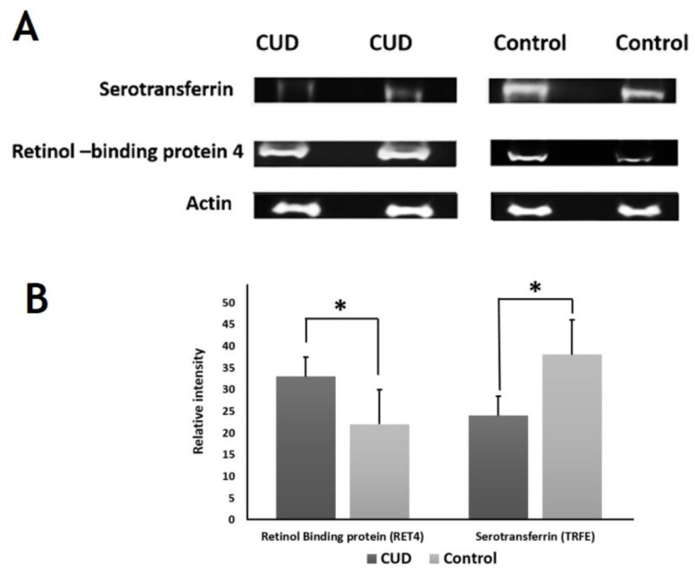 Western blot assay of the chosen proteins identified by 2D-DIGE analysis. Samples from CUD patients and controls were pooled together and used for western blot analysis. The results of Western blot study were similar to the findings of 2D-DIGE (A). Graphical analysis of the relative expression data of normalized protein blots between the control and CUD. The presented data are shown as histograms of the mean ± SD and * p > 0.05 (B).