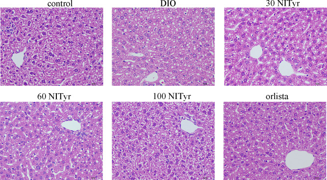 The liver tissue of mice stained by the H&E method. scar bar = 10 µm. The control or DIO group was treated with Poloxamer 188 aqueous solution. 30 NITyr, 60 NITyr, 100 NITyr and Orlistat were treated with 30 mg/kg NITyr, 60 mg/kg NITyr, 100 mg/kg NITyr, 100 mg/kg Orlistat, respectively.