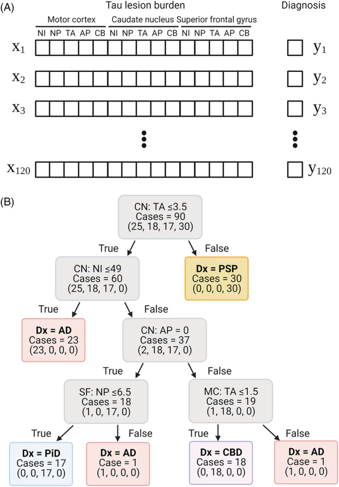 Decision tree classifier for diagnosing tauopathies. (A) Fifteen variables (x) and an answer label (y) per case are used for generating decision tree classifiers. (B) Ninety cases are used for training and creating the decision tree. All 90 cases are correctly classified using quantitative tau burden in the caudate nucleus, superior frontal gyrus and motor cortex. Values in parentheses indicate the number of AD, CBD, PiD and PSP cases, respectively. The first node asks whether the number of tufted astrocytes in the caudate nucleus is ≤3.5. If it is false, the diagnosis is PSP. If the result of first node is true, the second node asks whether the number of neuronal inclusions in the caudate nucleus is ≤49. If it is true, the diagnosis of AD is given. If it is false, the third node asks whether the number of astrocytic plaques in the caudate nucleus is = 0. If it is true, the last node asks whether the number of neuritic plaques in the superior frontal gyrus is ≤6.5. If it is true, the diagnosis of PiD is made, and if it is false, the diagnosis of AD is made. If the result of third node is false, the last node asks whether the number of tufted astrocytes in the motor cortex is ≤1.5. If it is true, the diagnosis of CBD is made, and if it is false, the diagnosis of AD is made. Abbreviations: AD, Alzheimer's disease; AP, astrocytic plaques; CBD, corticobasal degeneration; NI, neuronal inclusions; NP, neuritic plaques; PiD, Pick's disease; PSP, progressive supranuclear palsy; TA, tufted astrocytes