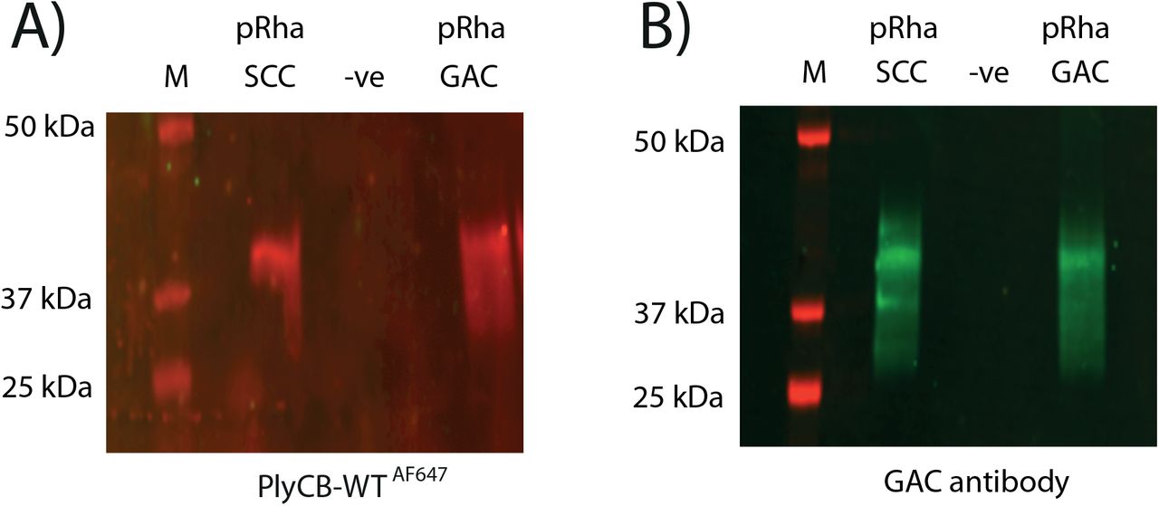 Representation of immunoblot analysis of the cell lysate of E. coli expressing the SCC and GAC pRha and carrying an empty control plasmid (−ve). A) Blot was incubated with PlyCB-Alexa Fluor® 647 (PlyCBWTAF647). B) Probing the same samples with the GAC antibodies confirms the presence of GAC in the bands. Molecular mass markers are given in kDa.