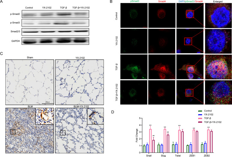 YX-2102 suppressed TGFβ1-Smad2/3 signaling and decreased EMT-associated transcription factors. A549 cells were pretreated with YX-2102 (5.0 µM) for 2 h and stimulated with TGF-β1 (5 ng/mL) for 24 h. Control cells were treated with DMSO. A WB analyses of p-Smad2/3 expression. B Confocal analysis of A549 cells stained with pSmad3 (green) and Smad4 (red) antibodies after TGF-β1 stimulated with/out YX-2102. Nuclei were counter-stained with DAPI (blue). Scale bar = 10 μm. C IHC evaluating the expression of p-Smad3 in the lungs of rats at 21 days (magnification ×200). Scale bar = 200 μm. D A549 cells (untreated or treated with 5.0 µM YX-2102 for 24 h), were stimulated or unstimulated with TGF-β1 (5 ng/mL). mRNA levels of slug, snail, ZEB-1, and twist were then determined using RT-qPCR. Data are expressed as mean ± SEM of three independent experiments. **P < 0.01 versus Sham groups. ##P < 0.01 versus the TGF-β group