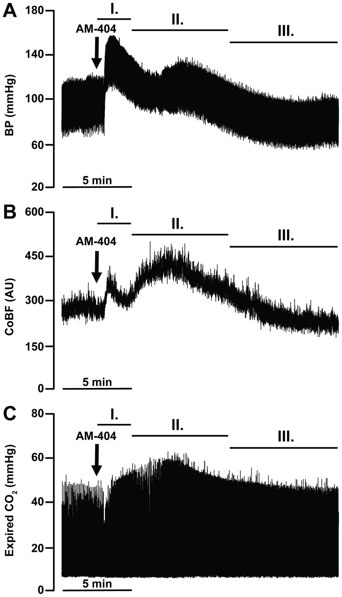 Representative recordings of the effects of endocannabinoid reuptake inhibition on blood pressure (A), cerebrocortical blood flow (B) and expired CO2 levels (C).After the intravenous administration of 10 mg kg−1 AM-404 a transient increase in blood pressure (BP) and cerebrocortical blood flow (CoBF) can be seen (phase I). It is followed by a second prominent increase in CoBF (phase II) that is accompanied with a rise of expired CO2. Thereafter a sustained decrease in the BP and CoBF can be seen (phase III). The arrows indicate the injection of AM-404.