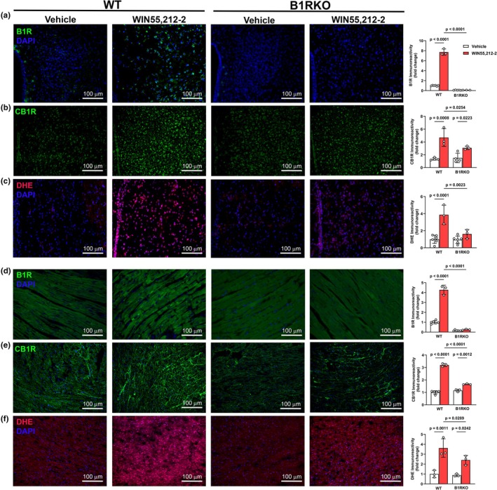 Brain and cardiac expression of B1R, CB1R, and oxidative stress following WIN55,212‐2 administration. Representative images and quantification of B1R (a), CB1R (b), and oxidative stress (DHE, c) expression in the paraventricular nucleus (PVN) of the hypothalamus. Images and corresponding expressions of B1R (d), CB1R (e), and oxidative stress (DHE, f) in heart tissue. WIN55,212‐2 increased CB1R expression and oxidative stress in WT but not B1RKO mice in both brain and heart. Data are presented as mean ± SD. n = 3–6 mice/group; 2‐way ANOVA with Tukey's multiple comparisons test.