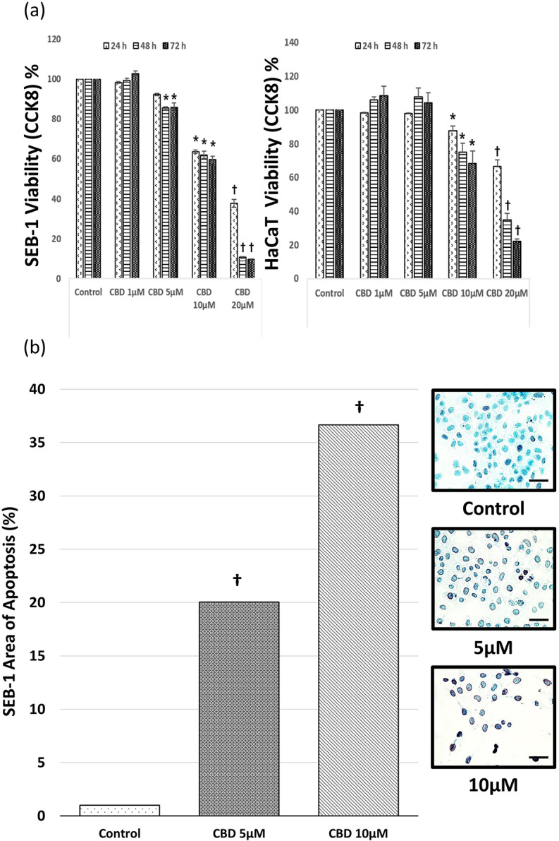 CBD induces apoptosis in SEB-1 cells and HaCaT cells. (a) SEB-1 cells and HaCaT cells were exposed to CBD at concentrations of 1, 5, 10 or 20 µM for 48 h, followed by confirmation of apoptosis using the TUNEL assay method. (b) Quantitative analysis of apoptosis staining was conducted and the results were graphed. Representative micrograph images of SEB-1 cells treated with CBD showing the induction of apoptosis (400X magnification). Data are presented from a sample size of n = 9 independent experiments. All are at the same magnification (bar = 50 μm). CBD, cannabidiol; TUNEL, terminal deoxynucleotidyl transferase dUTP nick end labeling. *, P < 0.05, †, P < 0.001