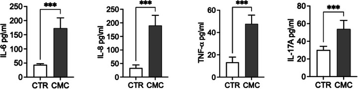 Evaluation of the pro‐inflammatory cytokines interleukin (IL)‐6, IL‐8, tumour necrosis factor‐alpha (TNF‐α) and IL‐17A in canine mammary carcinoma (CMC) cells expressed in pg/mL by enzyme‐linked immunosorbent assay (ELISA) test. The data are presented as mean ± standard error of the mean (SEM). Statistical significance versus control: ** p < 0.01; *** p < 0.001; **** p < 0.0001; ns = not significant.