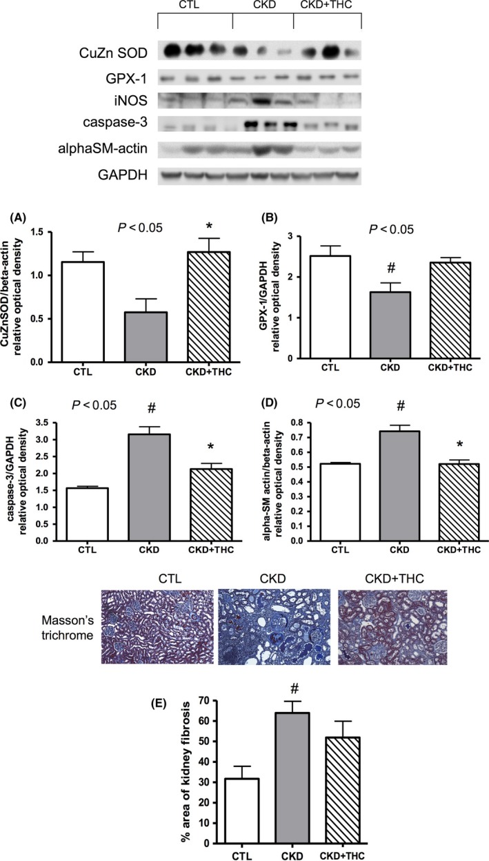 Improvement in markers of oxidative stress on western blot and histology. Western blots depicting protein abundance of oxidative stress, inflammation, and fibrosis mediators in kidney lysates from the 3 experimental groups. The antioxidant (scavenging) proteins (A) copper‐zinc superoxide dismutase (CuZn SOD), and (B) glutathione peroxidase (GPX‐1) were decreased in CKD and levels were restored with dietary THC therapy. The apoptosis marker (C) caspase‐3 and the fibrosis marker (D) alpha‐smooth muscle actin (alphaSM‐actin) were increased in the remnant kidney from CKD rats and were decreased with THC therapy. (E) Representative micrographs of kidney tissue from the 3 experimental groups, stained with Masson's trichrome to assess degree of fibrosis (percent area stained blue, 10X objective). Area stained blue was doubled in CKD vs CTL animals. This area was decreased ~20% with THC therapy. Data shown as mean ± SEM. # P < .05 vs CTL; *P < .05 vs CKD