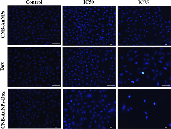 Nuclear morphology of DAPI stained nuclei of A549 cells treated with IC50 and IC75 of CNB-AuNPs-Dox, Dox, and CNB-AuNPs for 24 h analyzed by fluorescence microscopy. The images shown are representative of three independent experiments (Scale bar: 100μm; Magnification: ×20).