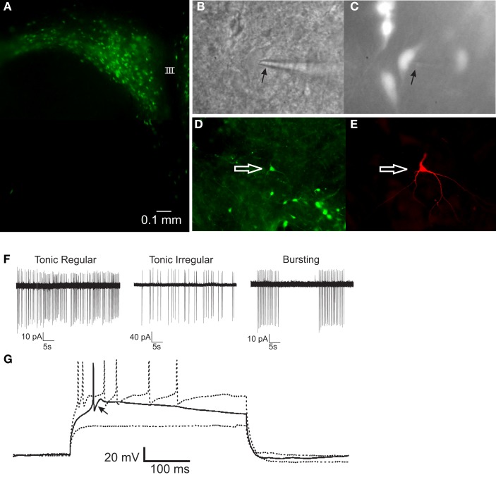 PRV-152-infected gastric-related preautonomic neuron recorded in the PVN. (A) Fluorescence micrograph of a PVN slice (300 μm) showing EGFP-labeled, gastric-related preautonomic neurons approximately 90 h after PRV-152 inoculation of the stomach. (B) Example of a PVN neuron that was recorded in the slice preparation. Arrow indicates to recording pipette. (C) The same neuron as in (B) illuminated with epifluorescence indicating it contained GFP. (D) Image of a slice from which a GFP-labeled PVN neuron was recorded. The arrow indicates the recorded cell. (E) Fluorescence image of the recorded cell [same as in (D)] filled with biocytin and visualized with an Avidin-Texas Red conjugate. (F) Loose-patch recordings of action potential activity demonstrating typical firing patterns in three PRV-152 labeled, gastric-related PVN neurons. (G) Current-clamp recording from a gastric-related preautonomic neuron that generated a low-threshold spike (arrow) in response to depolarizing current pulses (70–90 pA) from a membrane potential of −90 mV [same neuron as shown in (D,E)]. III, third ventricle.