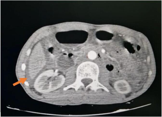 Fig. 2