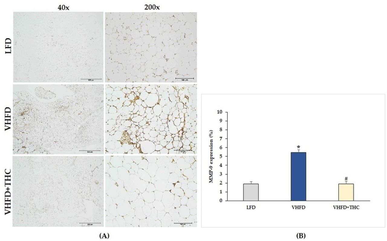 Effect of THC on MMP-9 expression in VHFD-induced obese mice:(A) Representative MMP-9 expression; left column, magnification 40×; scale bar = 500 μm; right column, magnification 200×; scale bar = 100 μm; (B) % MMP-9 expression. Data are presented as mean ± SEM. *p < 0.001 vs. LFD group; #p < 0.001 vs. VHFD group.