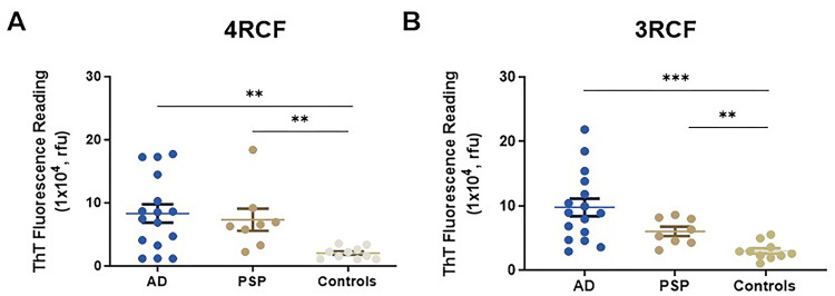 Examination of tau-SA in biopsied skin samples from patients with AD and PSP using 3RCF- or 4RCF-based RT-QuIC assay.The scatter plot displays the endpoint ThT fluorescence intensity for AD (n = 16), PSP (n = 8), and normal control samples (n = 10). **: p < 0.01; ***: p < 0.001.