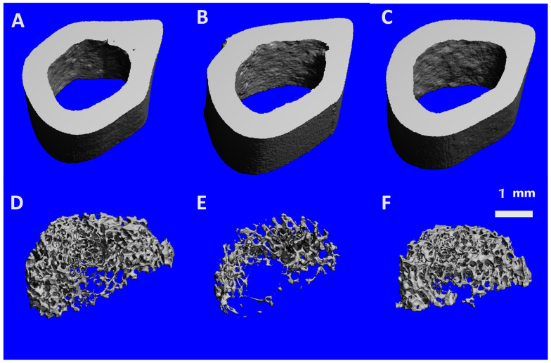 Surface-rendered microCT images. Representative series of femoral microCT images of mid-diaphyseal cortical regions of interest from (A) ShamSX + Air; (B) OVX + THC; (C) OVX + AIR; and proximal metaphyseal trabecular regions of interest from: (D) ShamSX + Air; (E) OVX + THC; (F) OVX + AIR. The scale bar represents 1 mm.