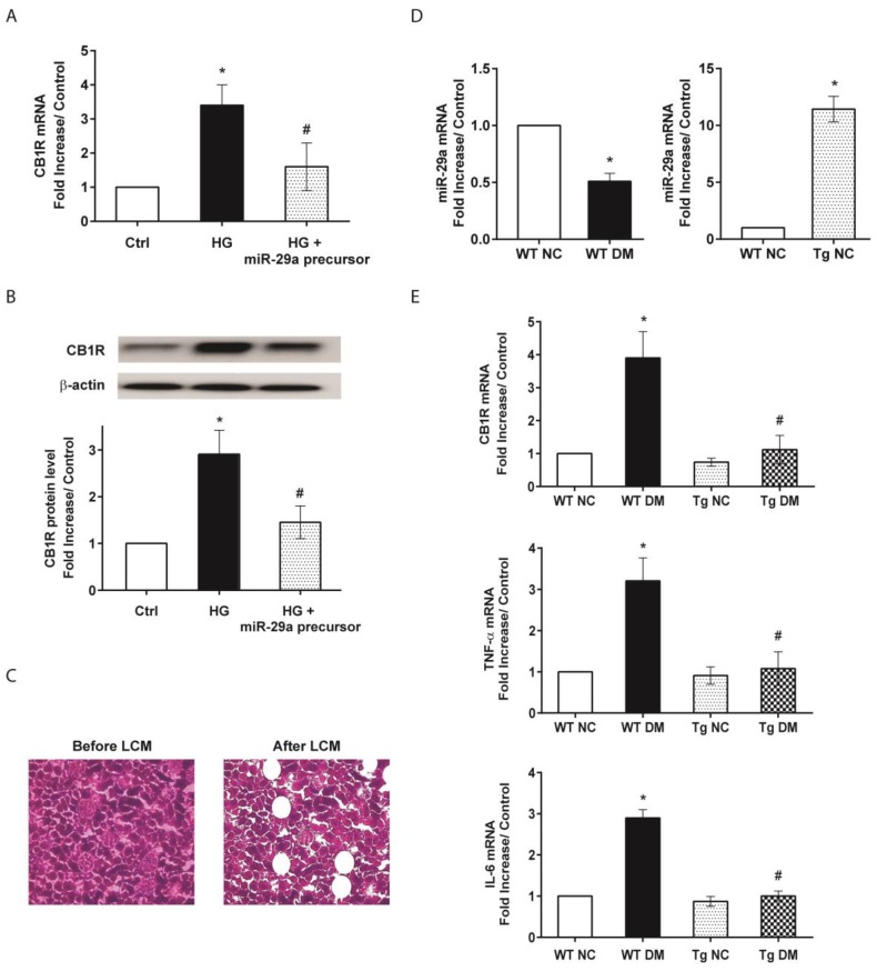 Influences of microRNA-29a (miR-29a) on the expressions of cannabinoid receptor type 1 (CB1R) and profibrotic genes in vitro and in glomeruli of diabetic mice. (A) Effects of high glucose (HG) and miR-29a precursor on CB1R expression in cultured renal mesangial cells by quantitative RT-PCR analysis. (B) Western blot analysis of CB1R protein in mesangial cells. Relative expression levels of CB1R protein quantified by densitometry are shown in the bottom panel. All experimental results from quantitative RT-PCR or Western blotting are presented as means ± standard error of the mean (SEM) calculated from three independent experiments. The symbol * indicates significant difference vs. the control group (p < 0.05); the symbol # indicates significant difference vs. the HG group (p < 0.05). (C) Isolation of glomerular components in renal tissues by laser capture microdissection (LCM). (D) mRNA expression of miR-29a in diabetic (left panel) and transgenic mice (right panel). (E) The mRNA expression levels of CB1R, tumor necrosis factor-α (TNF-α), and interleukin-6 (IL-6), normalized to that of β-actin, in glomeruli of wild-type normal control (WT NC), wild-type diabetic (WT DM), miR-29a transgenic normal control (Tg NC), and miR-29a transgenic diabetic mice were quantified by qRT-PCR (n = 6). The symbol * indicates significant difference vs. the WT NC group (p < 0.05); the symbol # indicates significant difference vs. the WT DM group (p < 0.05).
