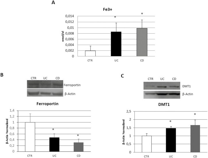 (A) Fe3+ intracellular concentrations (nmol/µL) in 7 patients with UC and 7 patients with CD compared with OCs from 7 healthy donors (CTR), determined by iron assay. The histogram shows the Fe3+ concentrations as the mean ± SD of independent experiments on each individual sample. (B) Ferroportin and (C) DMT1 protein expression in OCs from 7 patients with UC and 7 patients with CD compared with OCs from 7 healthy donors (CTR). Protein levels were determined by Western blot, loading 15 μg of total lysate. The most representative images are displayed. The protein bands were detected through Image Studio Digits software. The intensity ratios of immunoblots compared to CTR, taken as 1, were quantified after normalizing with respective controls. The relative quantifications for Ferroportin and DMT1 expression, normalized for the housekeeping protein β-actin, are represented in the histograms as the mean ± SD of independent experiments on each individual sample. A Student t-test was used for the statistical analysis. *P ≤ .05 compared to CTR. Abbreviations: CD, Crohn’s disease; CTR, controls; DMT1, divalent metal transporter-1; Fe3+, ferric iron ion concentration; OC, osteoclasts; SD, standard deviation; UC, ulcerative colitis.
