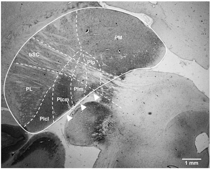Cytoarchitectonic boundaries of the subdivisions and nuclei of the pulvinar in the vervet monkey as revealed by calbindin staining. In a coronal section of the right pulvinar (solid line) processed for calbindin-DK28, the dashed lines outline the approximate location of the anatomical borders separating the main nuclei of the pulvinar thalamic complex according to the nomenclature of Stepniewska and Kaas [5]. The three PI nuclei integrating the dorsal stream of visual processing—PIcm, PIm and PIp—are indicated by arrowheads. These nuclei rest on the ventromedial aspect of the pulvinar and are bisected by the brachium of the superior colliculus (bSC) in their upper limits. bSC: brachium of the superior colliculus; PIcl: central lateral nucleus of the inferior pulvinar; PIcm: central medial nucleus of the inferior pulvinar; PIm: medial nucleus of the inferior pulvinar; Pip: posterior nucleus of the inferior pulvinar; PL: lateral pulvinar; PM: medial pulvinar. Scale bar = 1 mm.