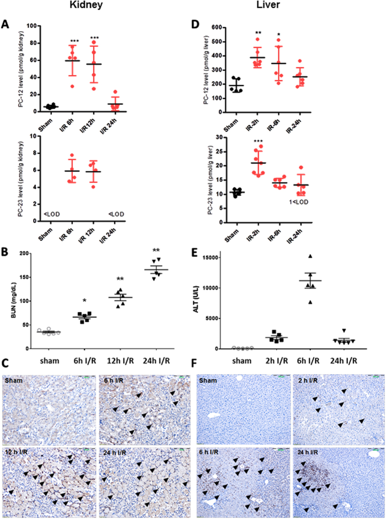 LC-MS/MS measurements of pepcan-12 and pepcan-23 in kidney and liver upon ischemia-reperfusion (I/R) damage and associated pathophysiology. (A) Time-dependent increase of PC-12 and PC-23 in kidney upon I/R damage in C57BL6 male mice. Bars show mean values ± SD., ***p < 0.001 vs. sham. < LOD, below limit of detection. (B) Time-course of renal I/R injury related blood urea nitrogen (BUN) levels, data show mean values ± SEM, n = 5, one-way ANOVA, *p < 0.05, **p < 0.01 vs. sham operated. (C) Representative micrographs of kidney samples after renal I/R injury at different time points after reperfusion (6 h, 12 h, 24 h). Arrowheads show Ly6G positive neutrophil granulocytes infiltrating the kidney following ischemic insult. Scale bar: 200 µm. (D) Time-dependent increase of PC-12 and PC-23 in liver upon I/R damage. Bars show mean ± SD. *p < 0.05, **p < 0.01 vs. sham. < LOD, below limit of detection. (E) Time-course of hepatic I/R injury related alanine aminotransferase (ALT) levels (units/liter), data show mean values ± SEM, n = 5–6, one-way ANOVA, **p < 0.01 vs. sham operated. (F) Representative micrographs of liver samples after hepatic I/R injury at different time points after reperfusion (2 h, 6 h, 24 h). Arrowheads show Ly6G positive neutrophil granulocytes infiltrating the liver following ischemic insult. Scale bar is 200 µm.