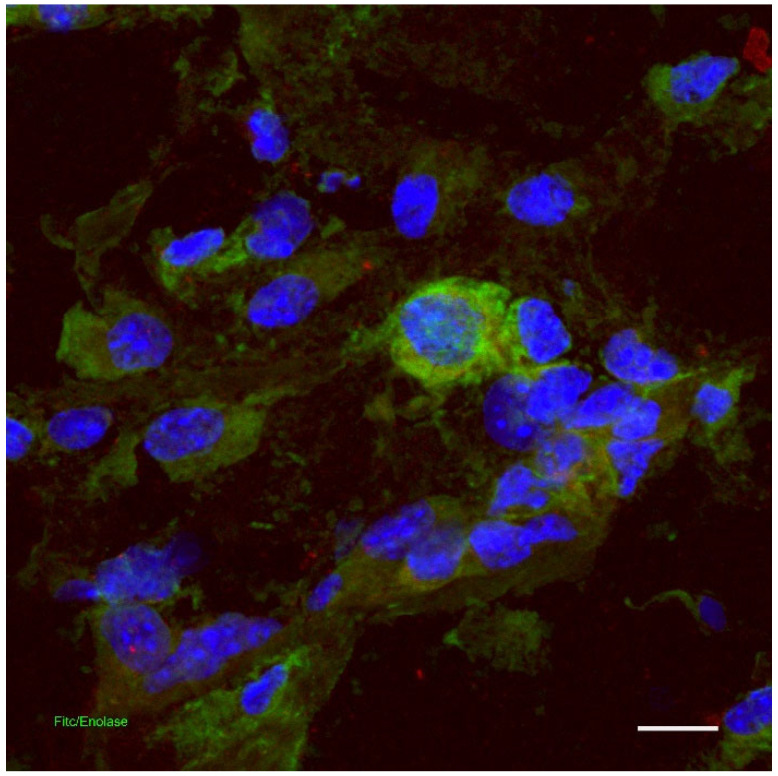 Dermis: Indirect immunofluorescence for the detection of neuronal enolase (green) in the skin and counterstained with DAPI (blue). Confocal microscopy, scale bar = 100 μm [15].