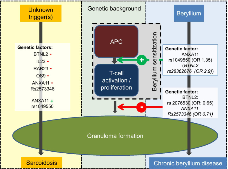 Sarcoidosis and chronic beryllium disease (CBD) share granuloma formation and clinical phenotype as common hallmarks. Genetic studies propose specific SNPs (e.g. in the BTNL2 and ANXA11 genes) contributing to disease development. Red—indicating enhanced susceptibility and green + indicating protection in sarcoidosis. In CBD, these SNPs influence disease initiation and progression differentially, which has not been studied so far in sarcoidosis. (APC: antigen presenting cells)