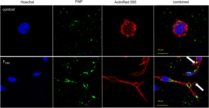 Representative examples of confocal images of macrophages following treatment with the control and FCBD (7 µg/mL). Control (0.7% v/v methanol) treatment served as the solvent (vehicle) control. Cell were stained for F-actin (EasyProbes™ ActinRed 555 Stain, red stain), and nuclei (Hoechst, blue stain); n = 5, in each biological replicate multiple cells were examined (see Table 2). Membrane filopodia-like structures are marked with white arrows. FNP, fluorescent-labeled silica 50–100 nm particles.