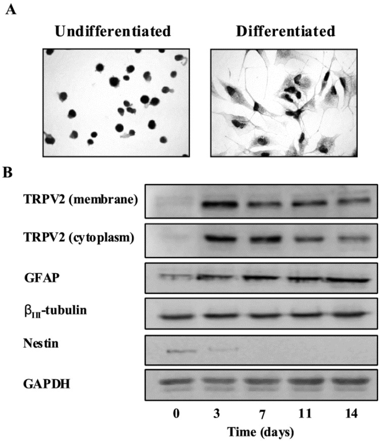 TRPV2 protein expression during GSC differentiation. (A) TRPV2 protein expression in undifferentiated and differentiated GSCs was evaluated by immunocytochemistry analysis. GSCs were incubated with goat anti-TRPV2 antibody followed by the respective secondary antibody. The detection was performed by avidin-biotin complex peroxidase method and diaminobenzidine (DAB) as a chromogen. The result shown that a moderate reaction that stains all the cytoplasm occurs in differentiated GSCs compared to the undifferentiated GSCs. (B) Membrane and cytoplasm fractions from undifferentiated or differentiated GSCs were immunoblotted with anti-TRPV2 antibody. Total lysates were also immunoblotted with anti-GFAP, anti-βIII-tubulin and anti-nestin antibodies. GAPDH protein was used as loading control.