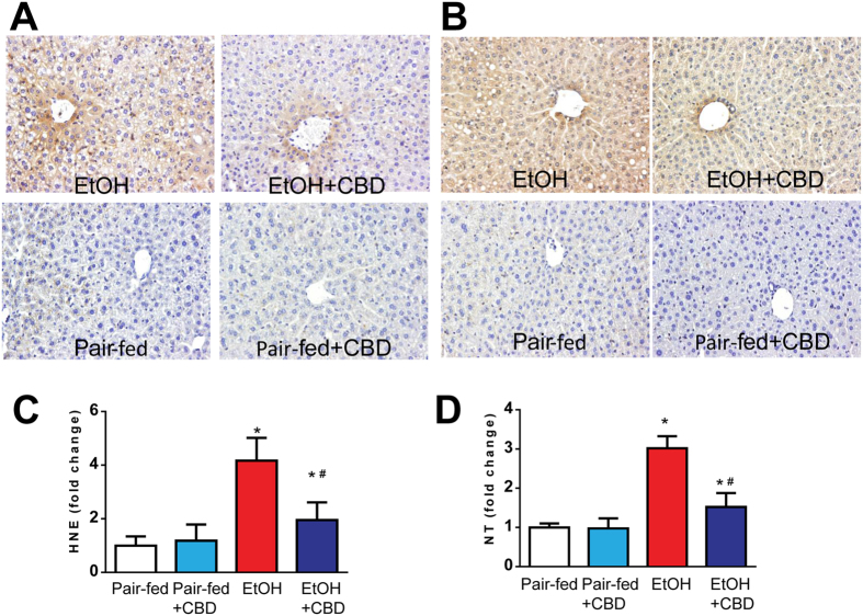 Effects of cannabidiol on ethanol-induced liver oxidative/nitrative stress. (A,B) Representative sections from each group with MDA and NT staining (markers of lipid peroxidation and protein nitration, respectively) at 200X magnification. Brown depicts increases of MDA and NT staining intensities in EtOH-fed groups. Panels (C) and (D) present quantification of HNE and NT ELISA respectively. Values represent means ± SEM (n = 5–7). *P < 0.05 vs. Pair-fed group, # P < 0.05 vs. EtOH group determined by One-way ANOVA, followed by Tukey’s post-hoc test.
