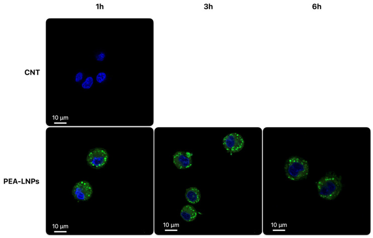 Confocal microscopy images of MH-S cells treated with coumarin-6 labelled PEA-SLNs after 1 h, 3 h, and 6 h, in comparison with not treated cells (CNT).