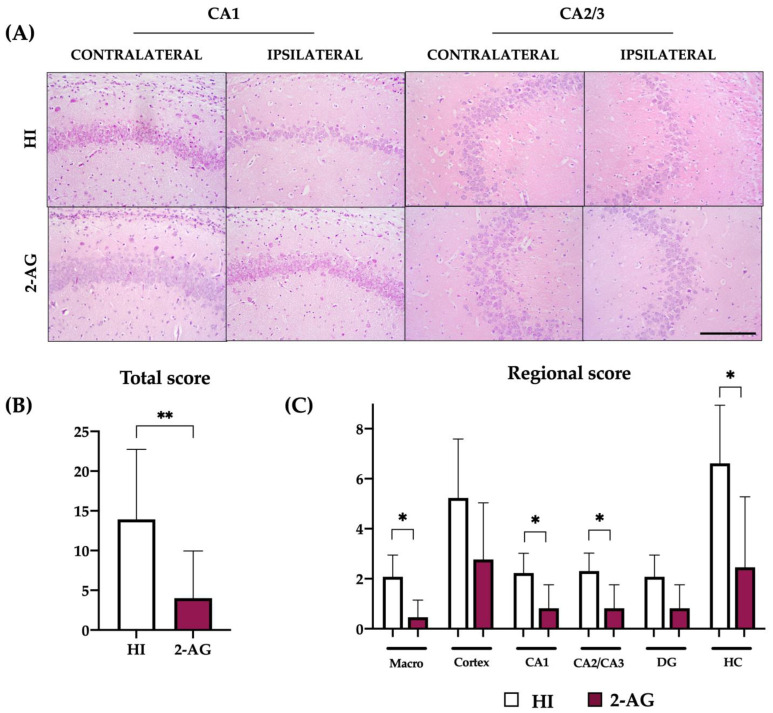 Treating animals with 2-AG resulted in lower global and regional neuropathological score values at P90. (A) Representative microphotographs of the contralateral and ipsilateral CA1 and CA2/3 regions of non-treated HI and 2-AG-treated animals. All images were taken at 20× magnification (Scale bar: 100 μm). (B) Global neuropathological score revealed significant (** p < 0.01) reduced damage in 2-AG-treated adult rats (P90). (C) Regional neuropathological scores were performed macroscopically (macro), in the cortex, in the CA1, CA2/3, and dentate gyrus (DG) areas of the hippocampus, and in the whole hippocampus (HC). Scores were higher in non-treated HI animals than in 2-AG-treated animals in all regions, but differences were only significant macroscopically, in the CA1 and CA2/3 regions and in the whole hippocampus (* p < 0.05).