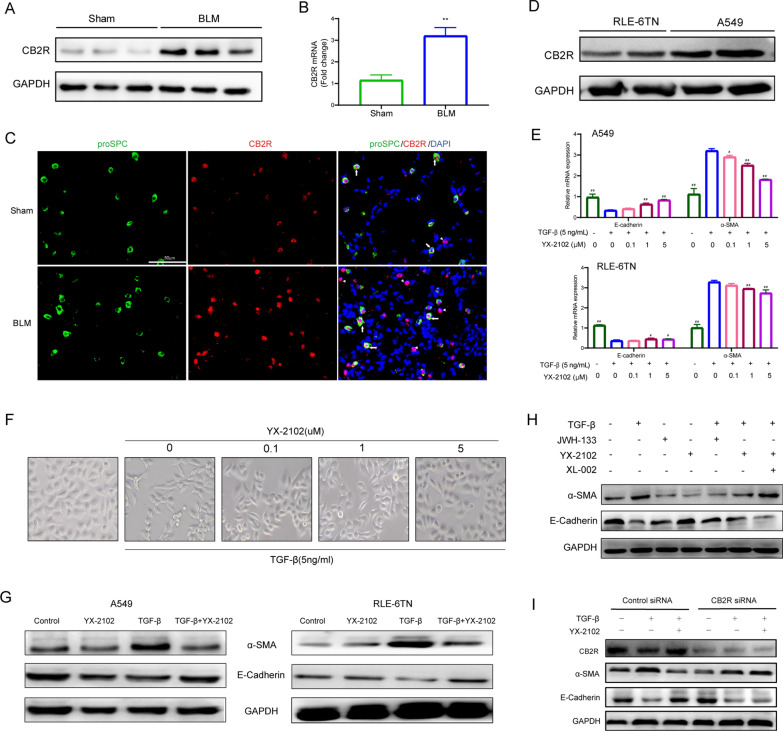 YX-2102 retarded TGF-β1-induced EMT in a CB2 R-dependent pathway. Rats were intratracheally treated with 5 mg/kg BLM once at day 0, followed by YX-2102 or vehicle treatment by intraperitoneal injection at a dose of 25 mg/kg daily. On day 21, rats were sacrificed and sampled. A, B Western blotting and qPCR were performed to evaluate the expression of CB2R in rats’ lung tissues of bleomycin-induced pulmonary fibrosis and sham group. C Immunofluorescence staining for Pro-SPC (green) and CB2R (red) in lung tissues. Arrows indicate epithelial cells with CB2R positive aggregates. Arrowheads indicate inflammatory cells with CB2R positive aggregates. Scale bar = 50 μm. D The expression of CB2R in A549 and RLE-6TN cells was evaluated by WB. E Cells were pretreated with 0.1, 1.0 or 5.0 µM indicated compounds for 2 h, followed by stimulation with 5 ng/mL TGF-β1 for another 48 h. DMSO treatment was set as control. The mRNA levels of E-cadherin and α-SMA were analyzed by qRT–PCR. F The morphological changes of A549 cells were observed at 48 h (magnification ×200). G Western blotting was performed to analyze the expression of E-cadherin and α-SMA in A549 (left panel) and RLE-6TN cells (right panel). H A549 cells were treated with YX-2102, JWH-133 or XL-002 for 2 h and stimulated with 5 ng/mL TGF-β1 for another 48 h. The levels of a-SMA and E-cadherin was assessed by western blotting. I Cells were transfected with 10 nM of control (scrambled) siRNA, CB2R-siRNA, subsequently pretreated with YX-2102 (5.0 µM) for 2 h, followed by TGF-β1 (5 ng/mL) treatment for 48 h. The expression of CB2R, α-SMA and E-cadherin was assessed by western blotting. Data are expressed as mean ± SEM, n = 5, **P < 0.01 versus the Sham group, #P < 0.05, ##P < 0.01 versus the TGF-β group (TGF-β = 5 ng/mL, YX-2102 = 0 µM)