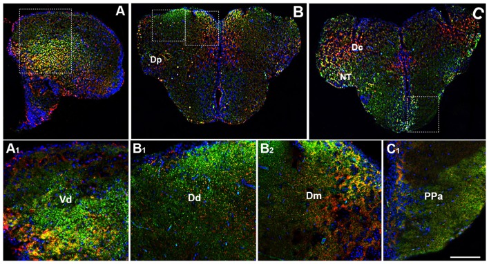Distribution of OX-2R (red) and CB1R (green), and their co-localization OX-2R/CB1R (yellow) in coronal sections of the telencephalon. (A–C) OX-2R/CB1R co-expression has been observed in the dorsal and ventral telencephalon of zebrafish brain. (A1) Higher magnification of the field boxed in (A) showing the OX-2R/CB1R co-expression within the dorsal nucleus of the ventral telencephalon (Vd). (B1,B2) Higher magnification of the fields boxed in (B) showing the OX-2R/CB1R co-expression within the dorsal (Dd) (B1) and medial (Dm) (B2) part of the dorsal telencephalon. (C1) Higher magnification of the field boxed in (C) showing the OX-2R/CB1R co-expression within the parvocellular preoptic nucleus, anterior part (Ppa). DAPI (Blue) was used as a counterstaining to show nuclei. Dc, central part of the dorsal telencephalon; Dp, posterior part of the dorsal telencephalon; NT, nucleus taeniae. Scale bar, 250 μm for (A–C); 50 μm for (A1,B1,B2,C1).