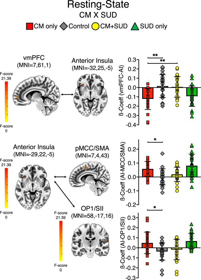 Resting-state connectivity.A 2 x 2 LME analysis was performed on beta coefficients resulting from seed-based time-course connectivity, with factors: CM (yes/no) and SUD (yes/no). Per voxel P = 0.002, multiple comparison corrected at alpha = 0.05. Bar charts reflect ß-Coefficients extracted on significant clusters for the significant CM x SUD interaction, and post-hoc significant difference for the CM only group. *P < 0.05, **P < 0.01, ***P < 0.001.