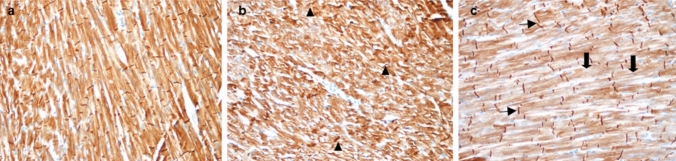 a Normal staining in myocytes with desmin antibodies, Control group, Score 0. × 200, b Slightly decreased staining and moderately increased contraction bands in myocytes with desmin antibodies (arrowhead), SAHD group, Score 2. × 200, c Decreased staining (thick arrow) and increased contraction bands (thin arrow) in myocytes with desmin antibodies, SALD group, Score 3. × 200
