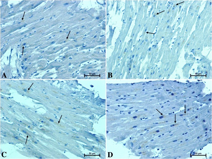 Positive CacyBP/SIP-immunostaining in heart of patients under 50 years old a men b women and over 50 years old c men d women